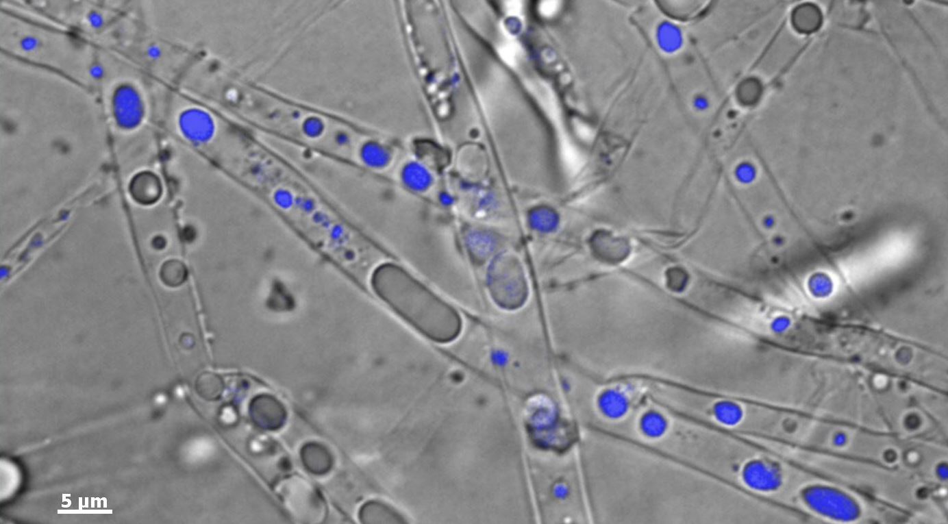 'Fungal pipeline' - Hyphae promote contaminant bioavailability by uptake, cytoplasmic streaming and release of phenanthrene (in blue) (© Susan Foß / UFZ)